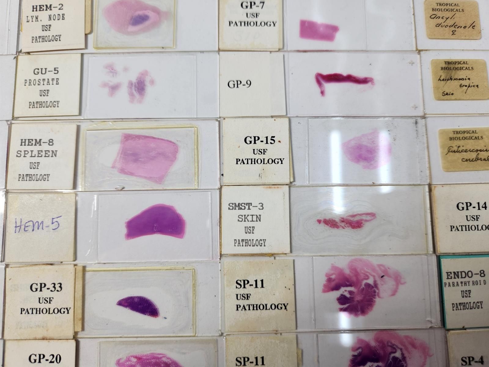 Lot Of 50 Vintage University Prepared Pathology Microscope Slides - Slides Only