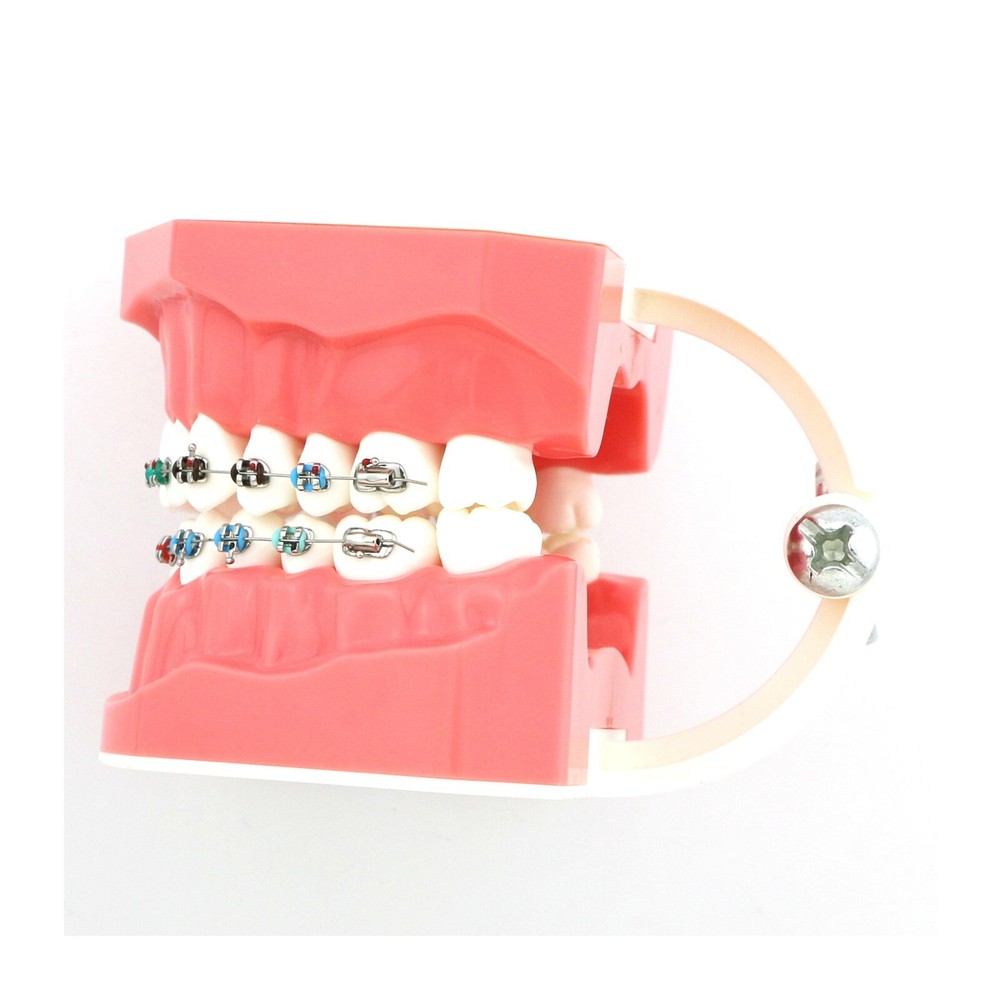 US Dental Typodont Brushing Flossing Practice Teeth Model with Metal Brackets