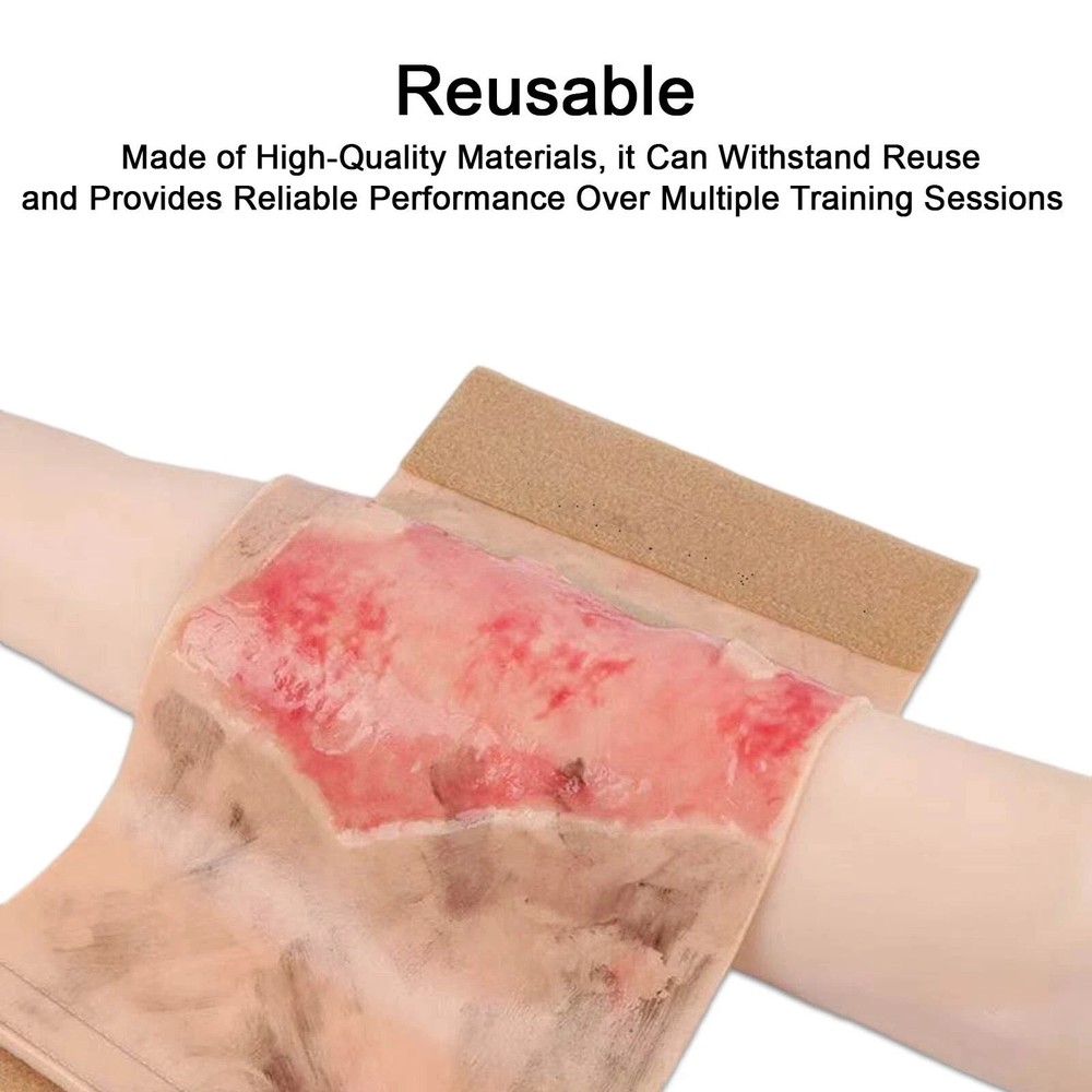 Limbs Burn Training Model, Realistic Wound Simulation Module Simulated Skin