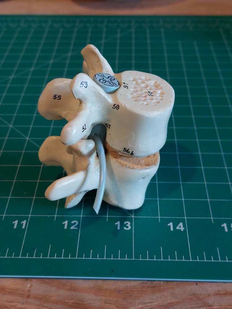 Human Spine Vertebrae Model – Anatomical Teaching Tool – Medical Display