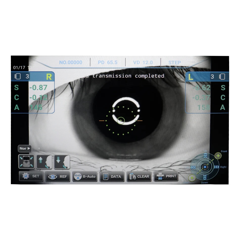 Auto Refractor Keratometer Ophthalmic Refractometer With Tracking Function