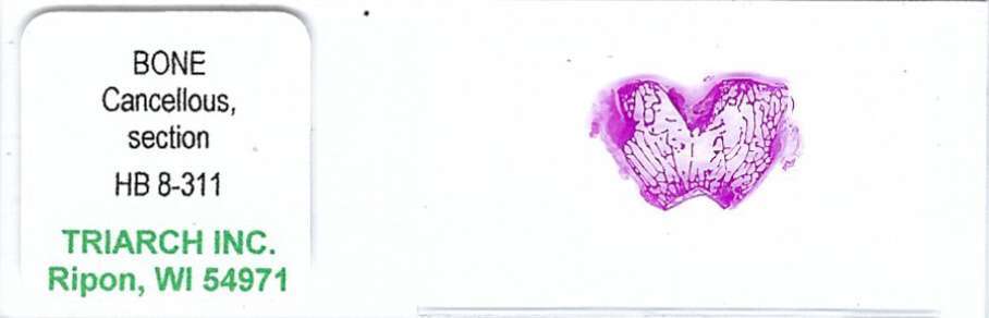 Cancellous Bone Microscope Slide