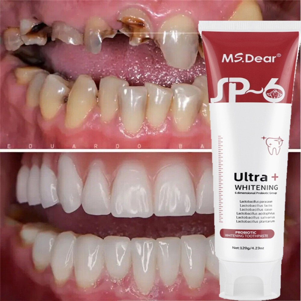 2Pcs Super Probiotic SP-6 Toothpaste, Probiotics Bright White Toothpaste, Sp 6