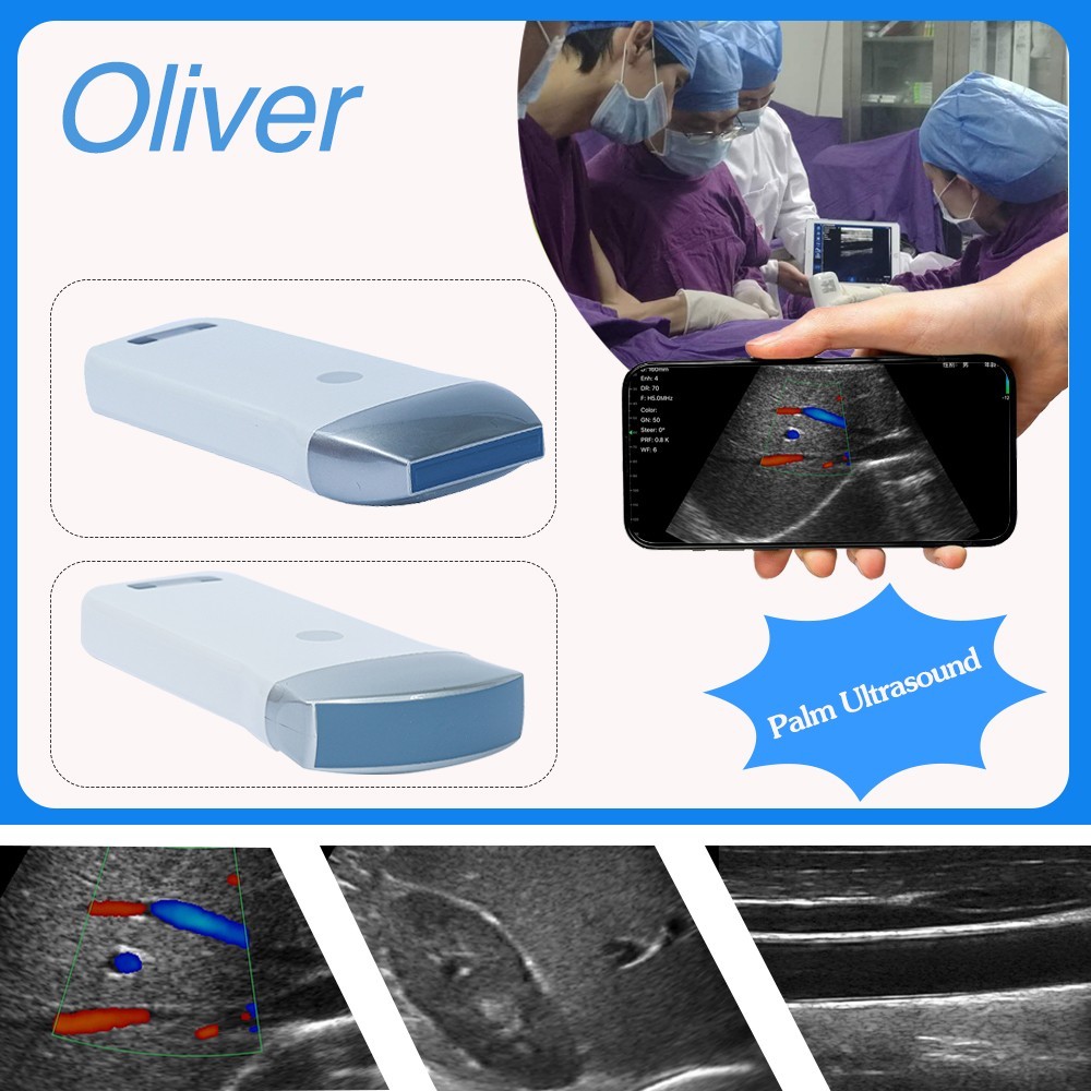 Portable Wireless Ultrasound linear Scanner Probe 80 element