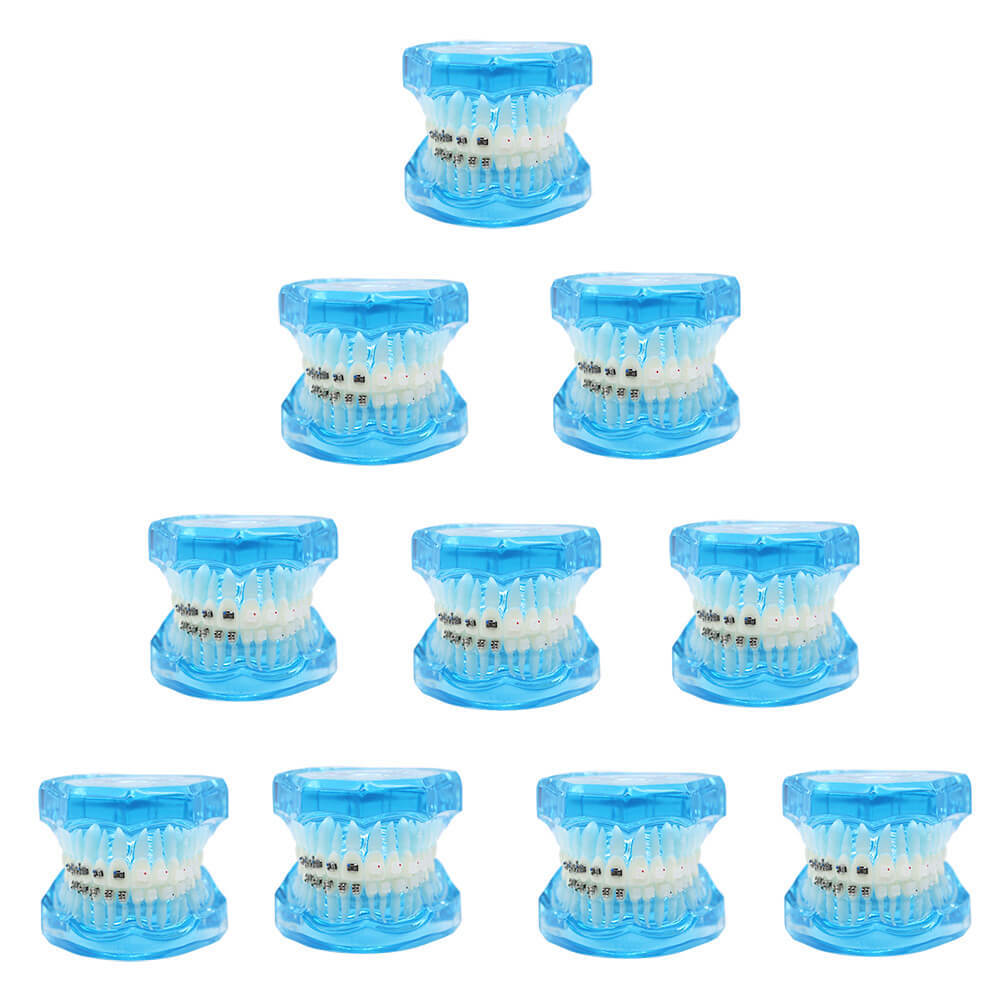 Dental Orthodontic Study Model with Metal & Ceramic Brackets for Teaching