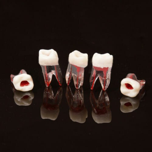Dental Lab Tooth Root Canal Model For RCT Practice Block Pulp Study Cavity Tool