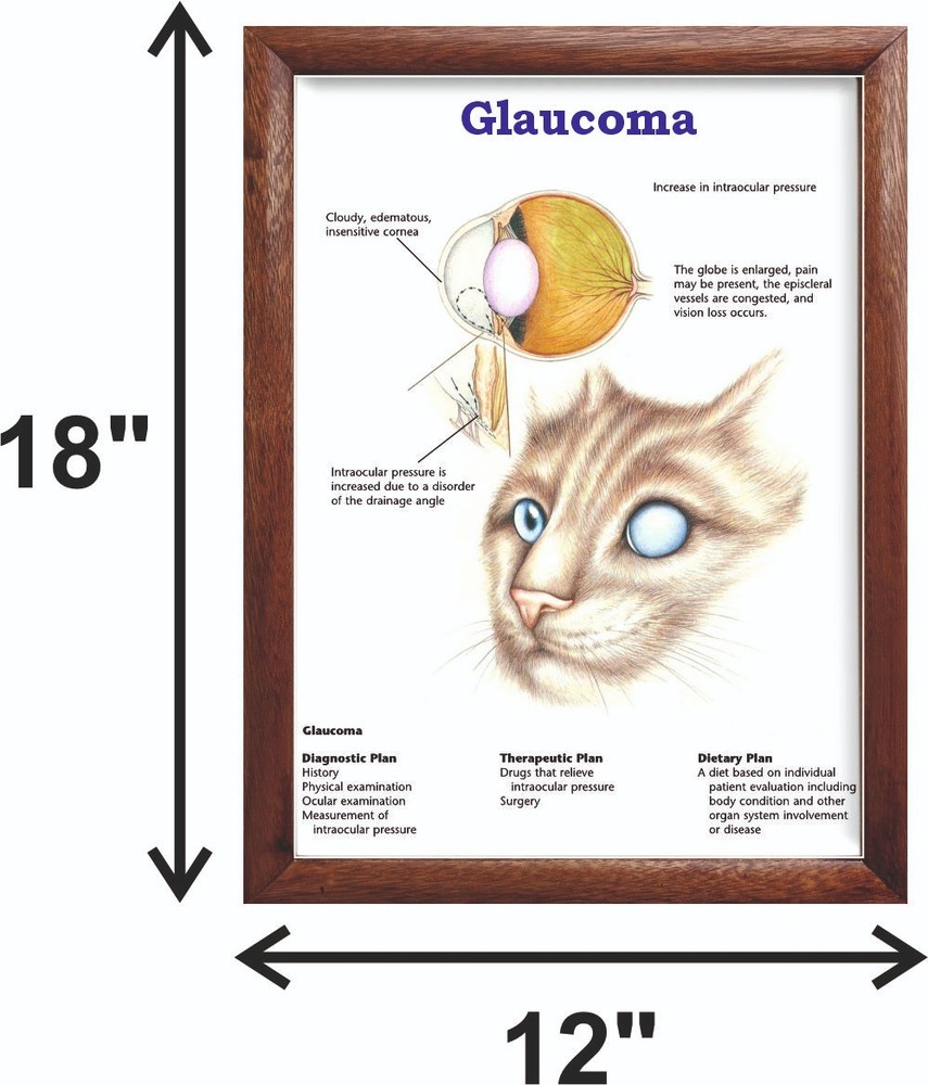Glaucoma Chart 12x18 inches