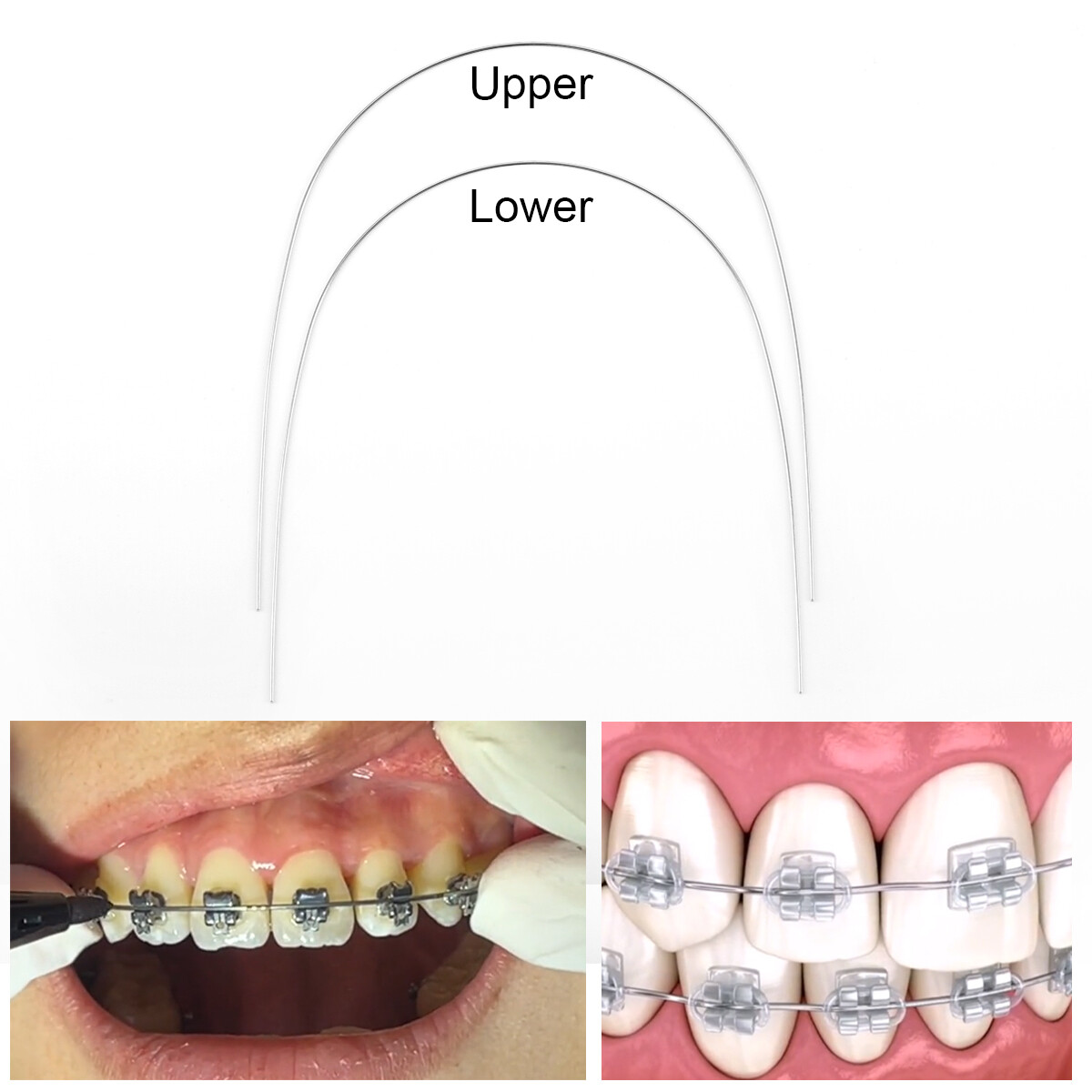 AZDENT arcos de ortodoncia niti super elástico circular forma natural dental USA