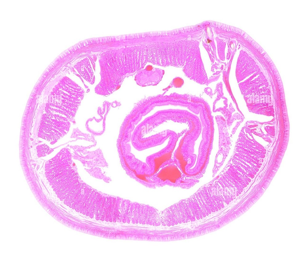 ABGIL Annelida Slides.