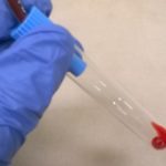 Hematype Segment Device Alternative