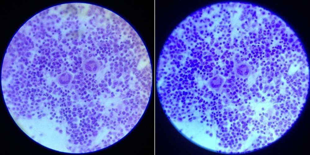 Antique Carl Zeiss Bitumi Binocular Attachment 1925 Microscope Accessory