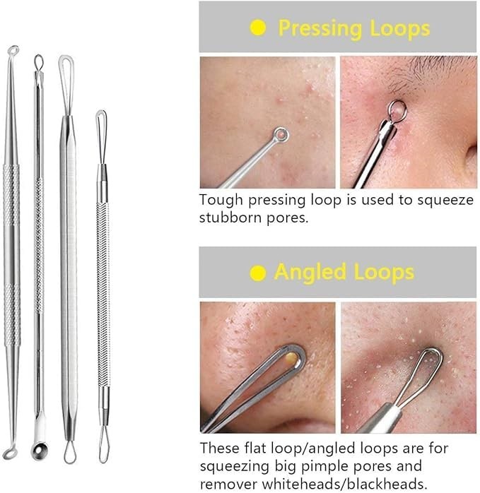 Acne Needle Blackhead Remover - Pimple & Comedone Extractor Tool Kit with Tweeze