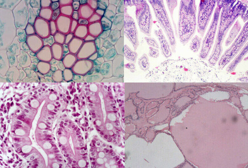 25pcs Biological Microscope Glass Slides & Educational Specimens with Locked Box