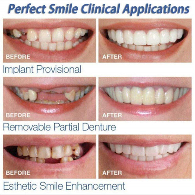 High Quality Upper&Lower Fake Tooth Kit Teeth Veneers Denture False Teeth Cover
