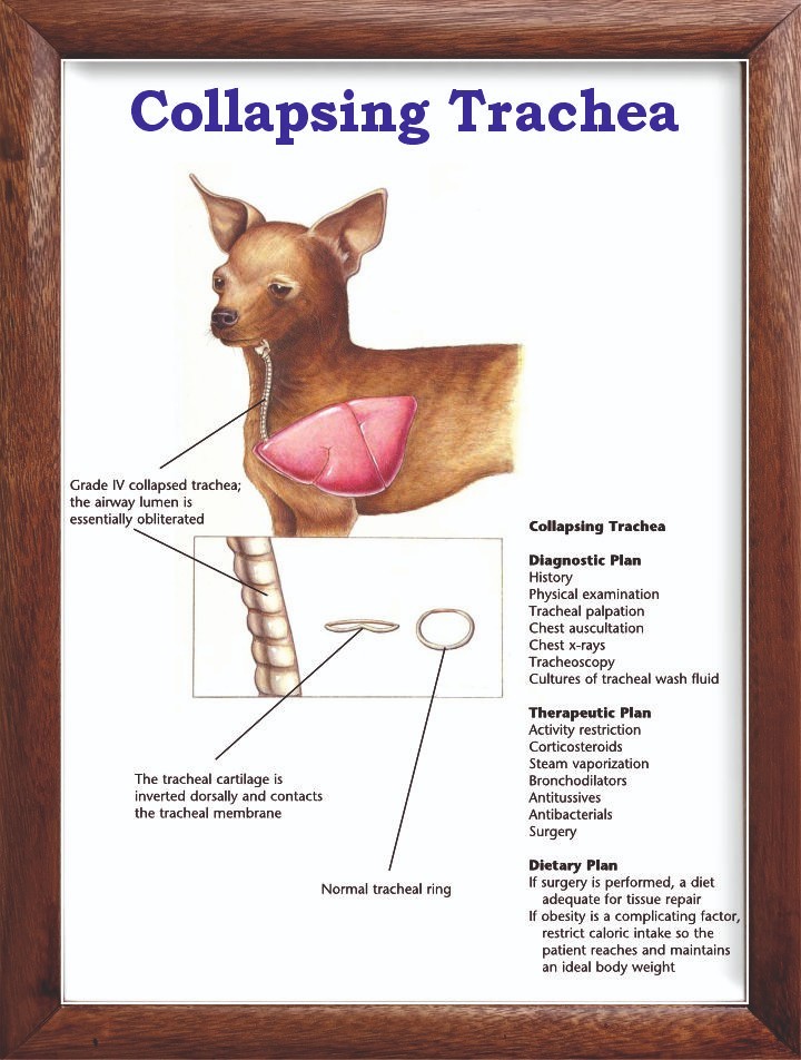 Collapsing Trachea Chart 12x18 inches