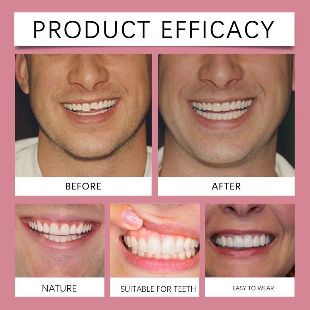 Silicone Denture Set Professional Denture Set Silicone Denture Set supple