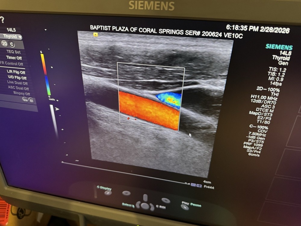 Siemens Acuson 14L5 Multi-D Transducer Probe
