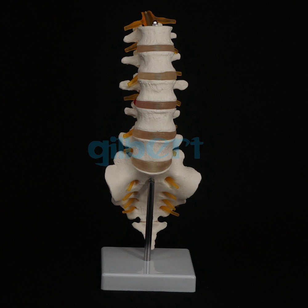 Human Lumbar Spine with Caudal Vertebra Structure Intervertebral Disc Model
