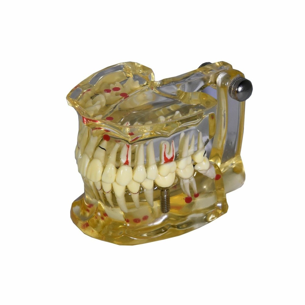Redland Model Dental Demonstration Teeth Educational Model