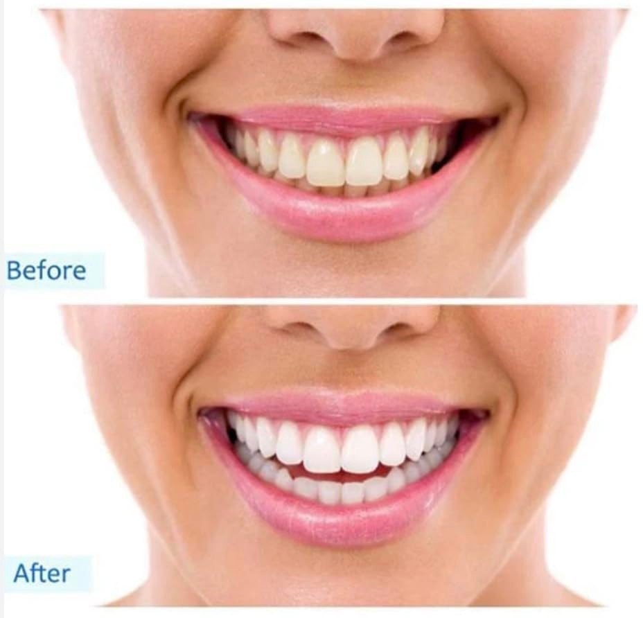 Pepsodent Complete Care Original Toothpaste 5.5 oz (Select Pack)