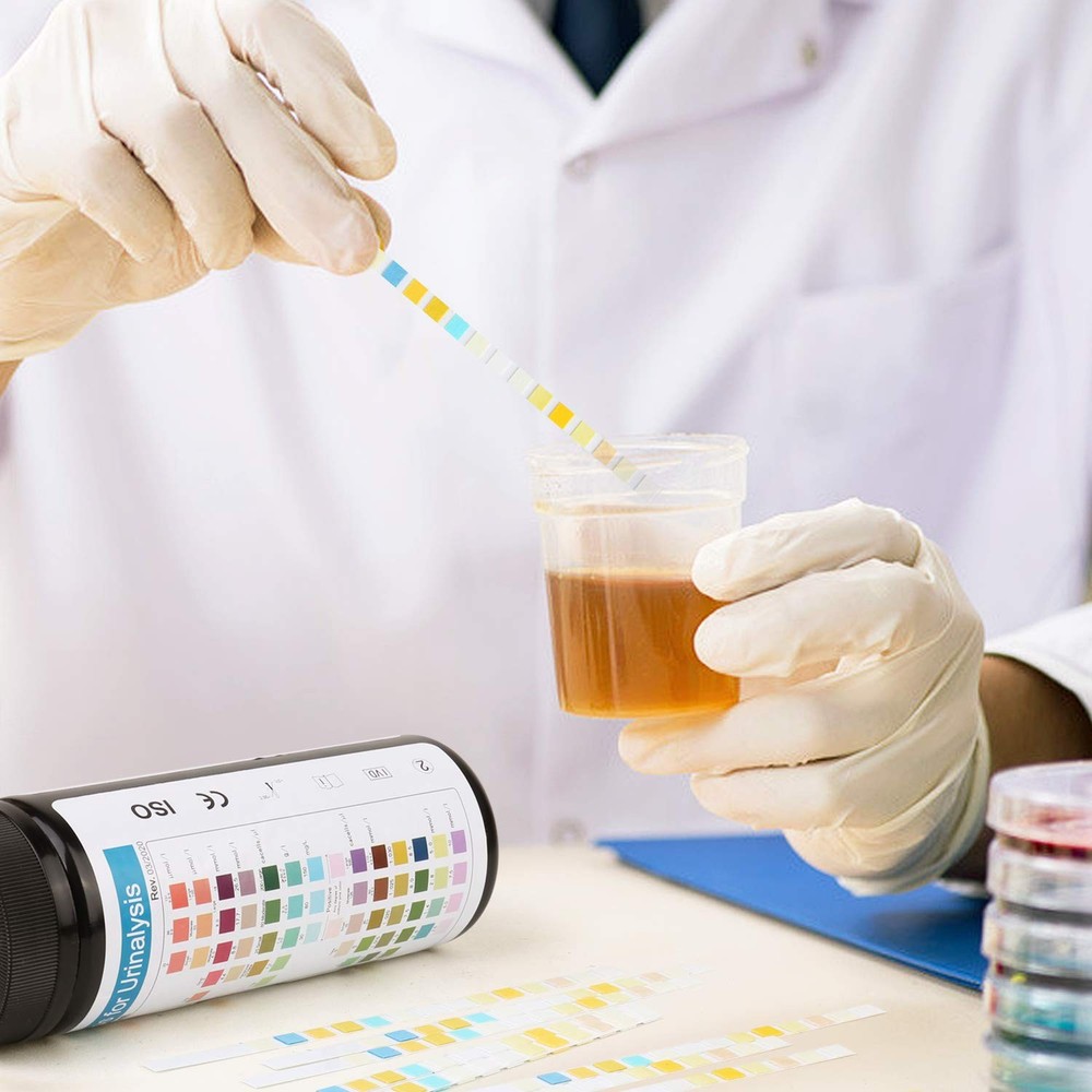 Urine Test Strips 14 Parameters 100 Count