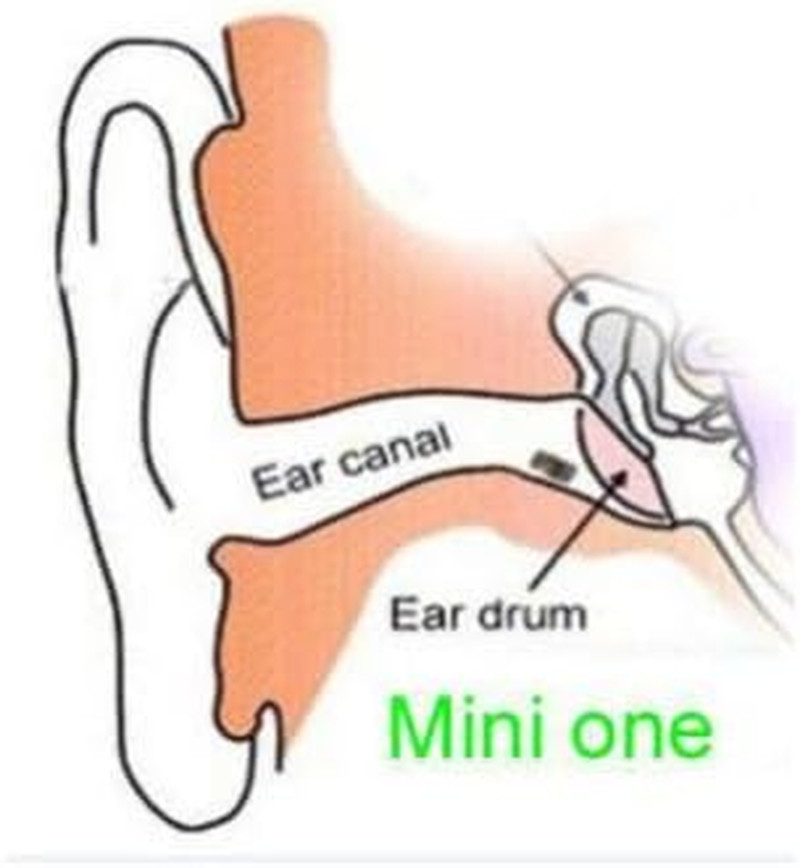 Mini Spy Earpiece Invisible Earphone Cheat Covert Earpiece for Mobile Phone