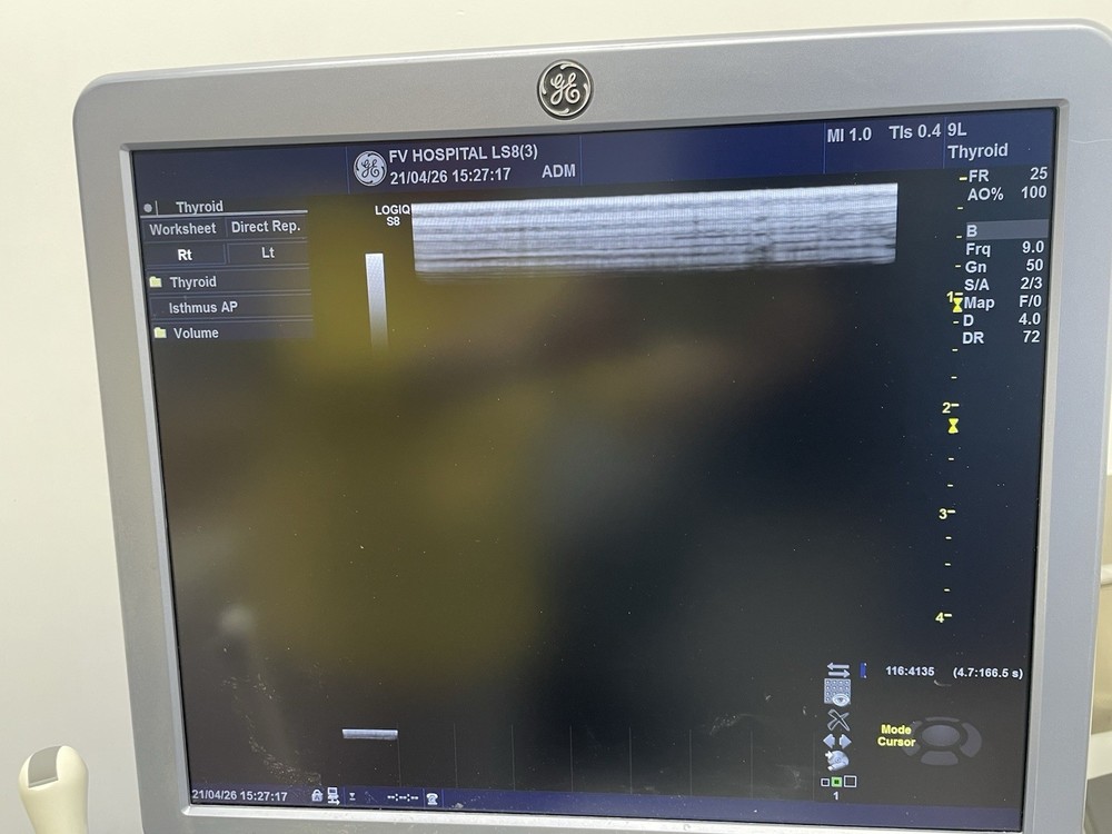 Ge ultrasound probe Linear 9L-D