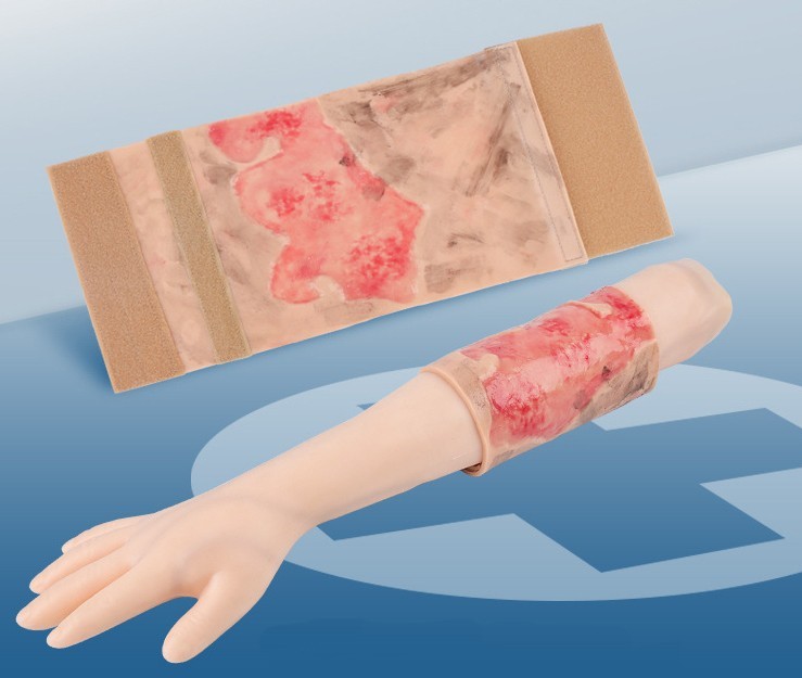 Limbs Burn Training Model, Realistic Wound Simulation Module Simulated Skin