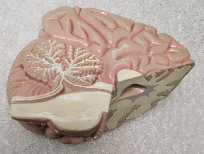 GPI Brain/ Partial Skull Model