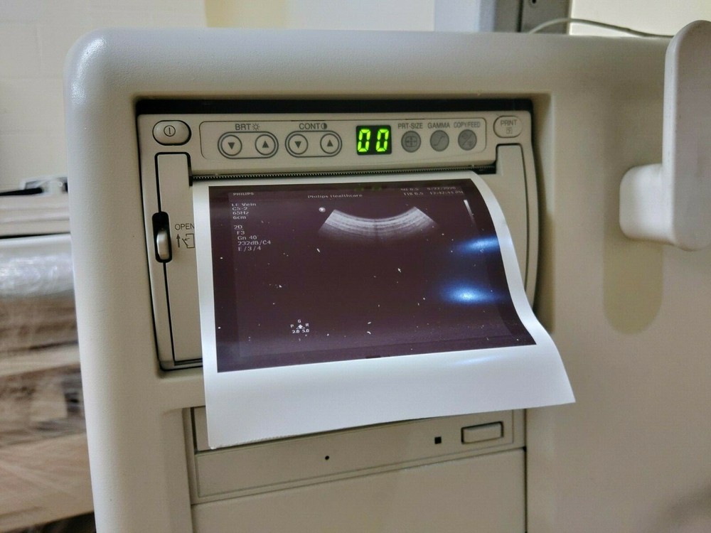 Philips HD11 XE Ultrasound