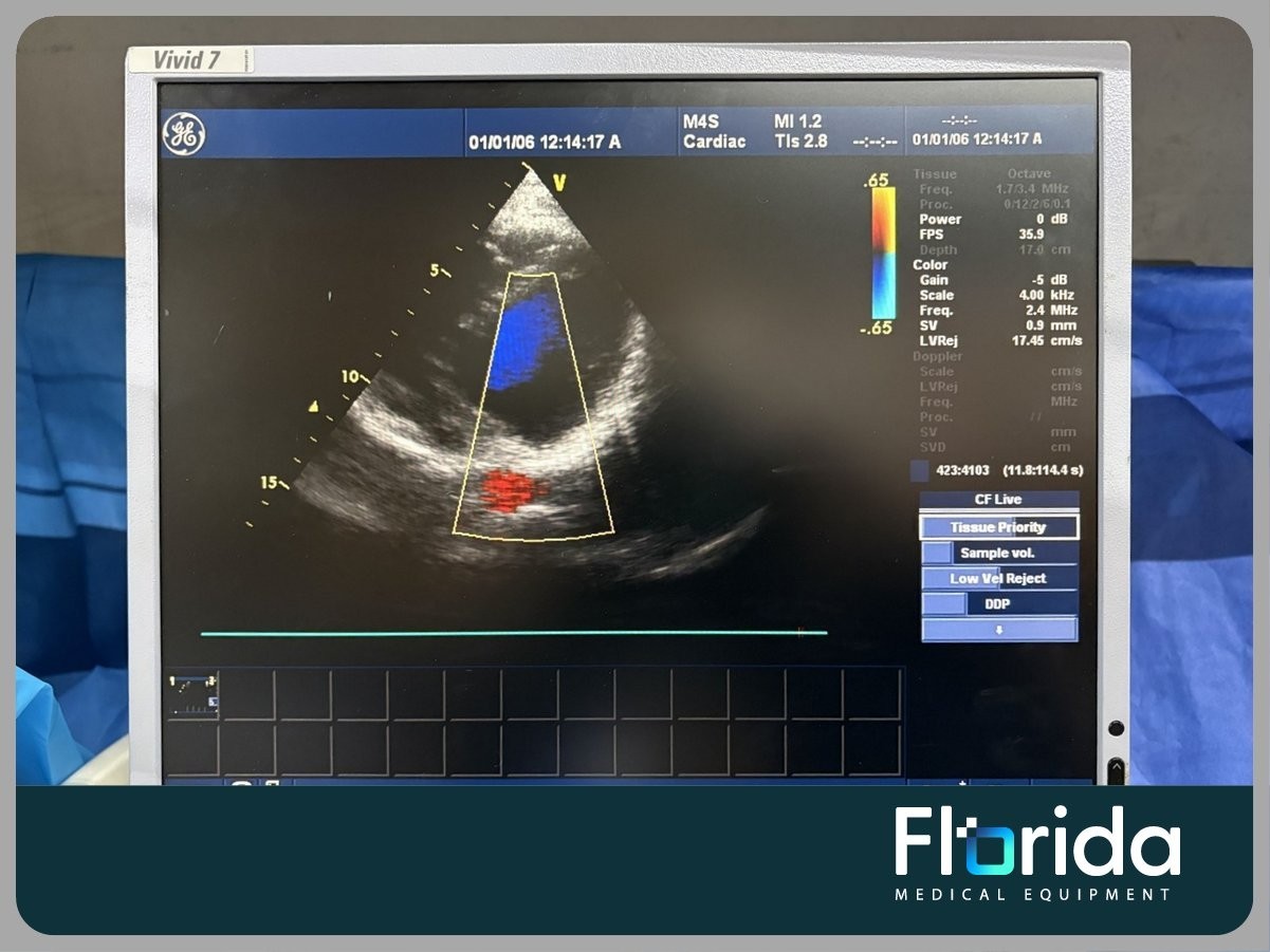 2007 GE M4S SECTOR ARRAY ULTRASOUND TRANSDUCER PROBE REF: 5129041 TESTED