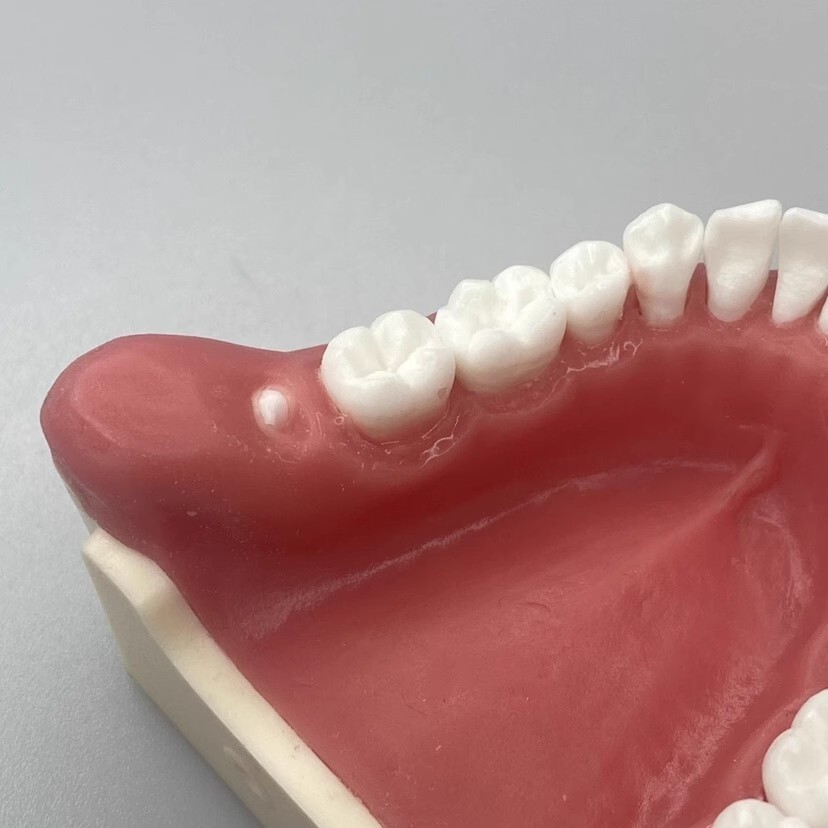 Dental Tooth Extraction Practice Model Dental Training Product Display