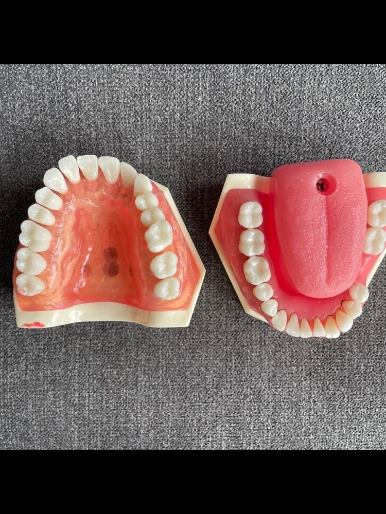 Periodontics Dentoform (Used in Simulation Lab)