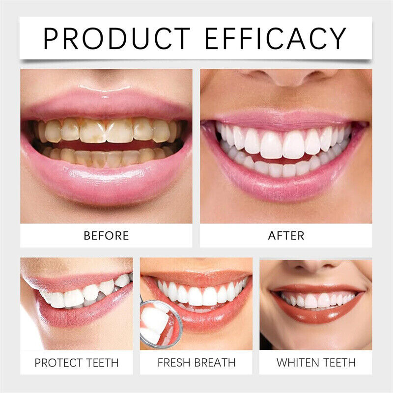 7.5% Hydroxyapatite Toothpaste Remove Yellow Tooth Stains For Sensitive Teeth~