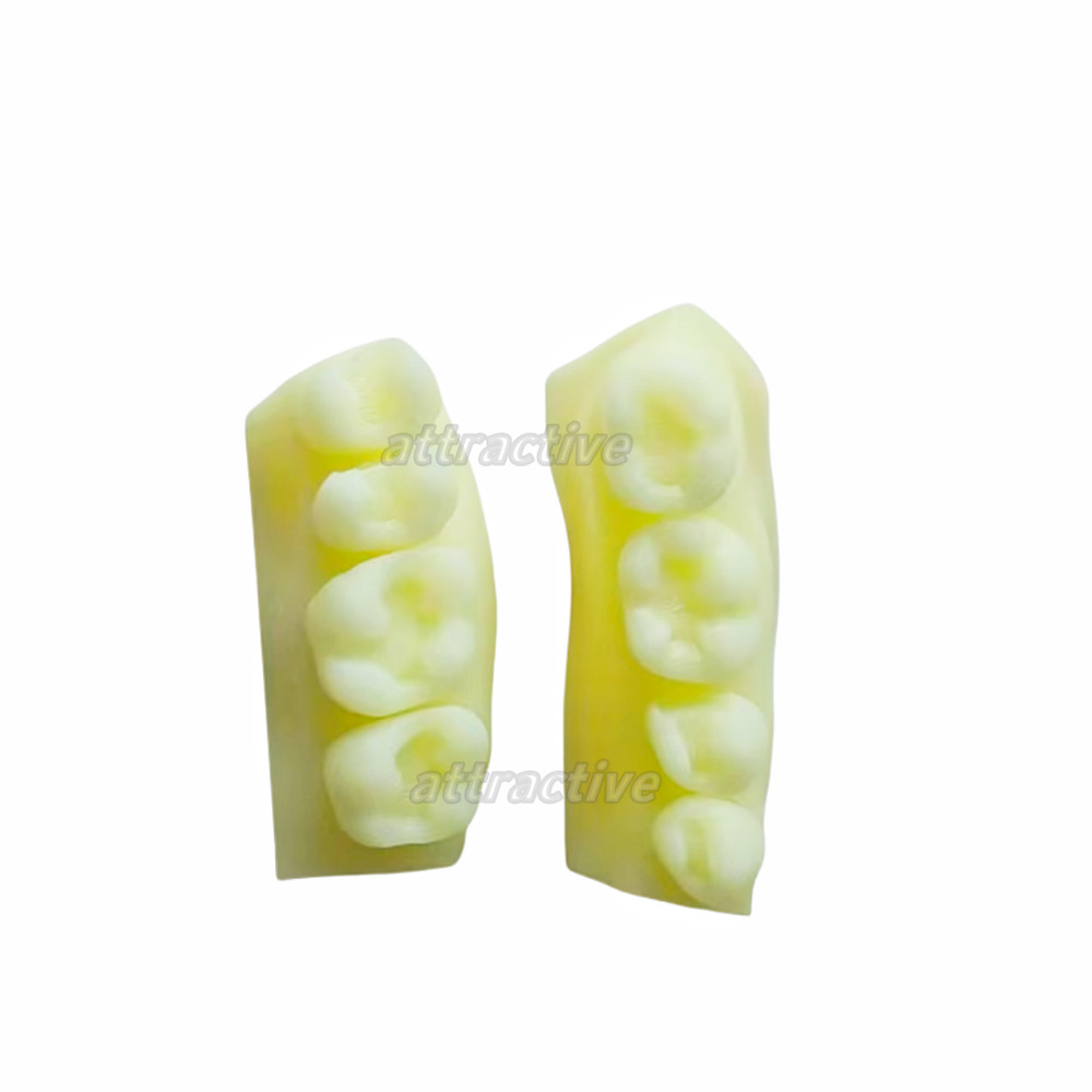 Dental Caries Decay Teeth Model Composite Resin Restore Tooth Simulate Class Ⅱ