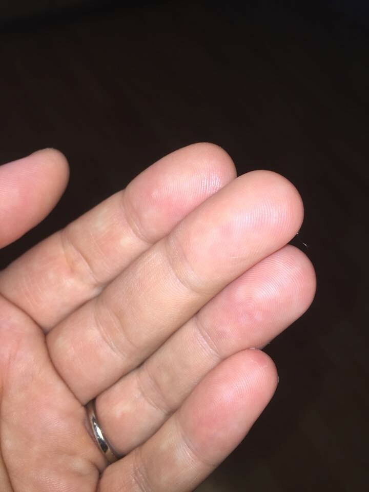 Grandmas Healing Products 1oz- Pine Tar Salve - A Black Drawing Ointment