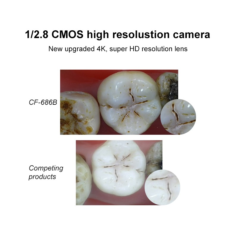 Dental Intraoral Camera USB Digital lmaging Intra Oral HD Camera 4K Mega Pixel