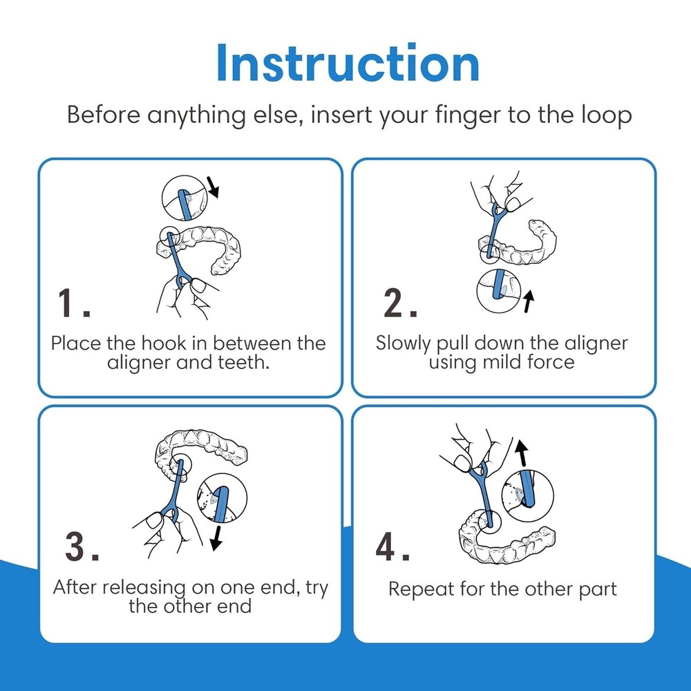 Blue Aligner Remover Tool - Protects Nails while Ensuring Safe Removal - 1-Pack