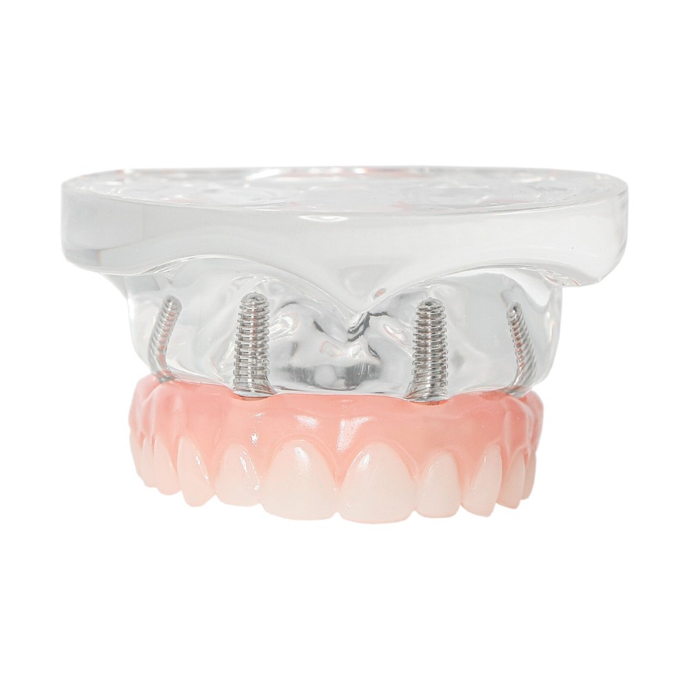 Implant Practice Demo Multiple Types Dental Teaching Teeth Model Typodont Ortho