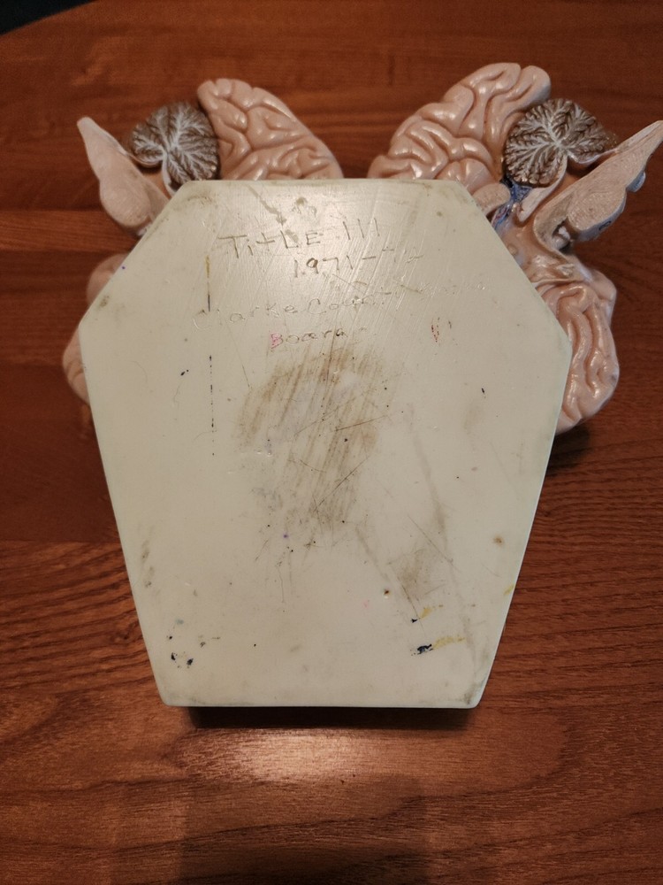 2-Part Brain Model Anatomy Model