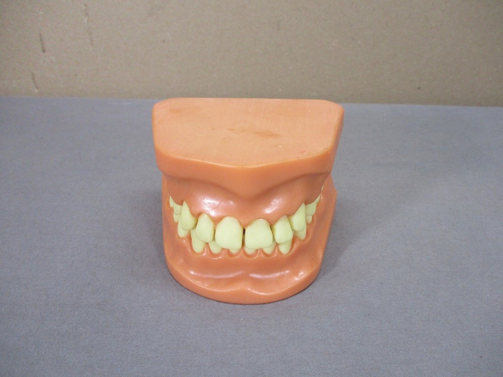 Dentist Typodont Dentoform Dental Model Teeth Overbite Tooth Display Hinged Set