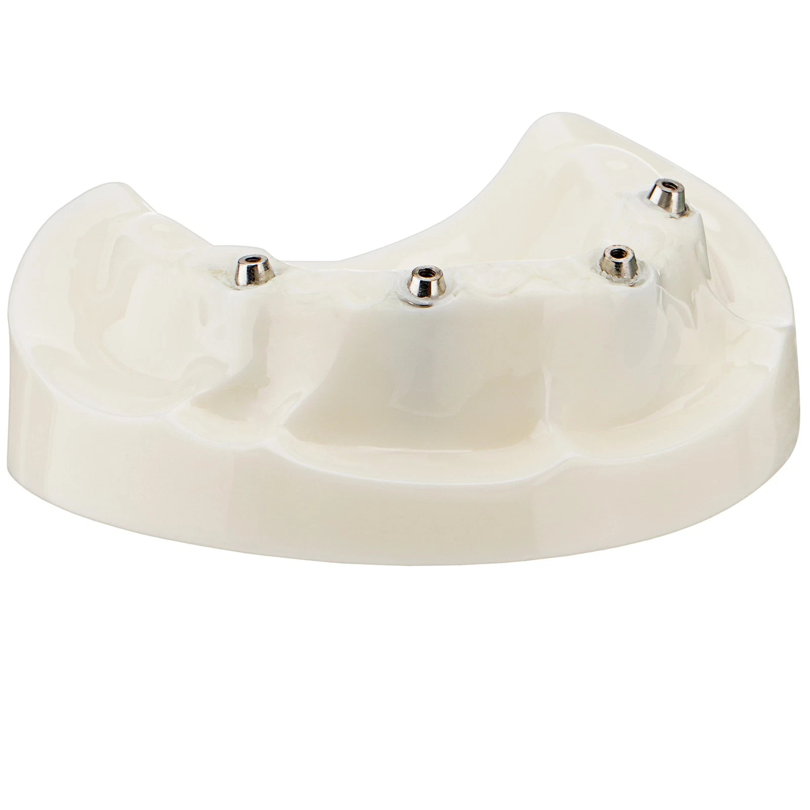 Dental All-on-4 Overdenture Model Dental Upper Jaw Implants Restoration 4 Screws