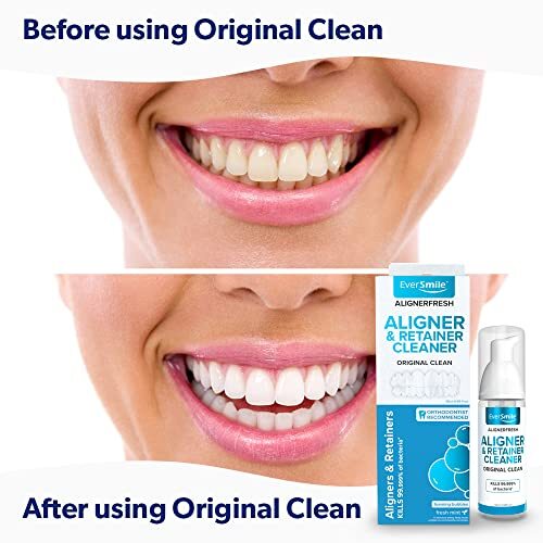 EverSmile AlignerFresh Original Clean - AlignerFresh Cleaning Assorted Sizes