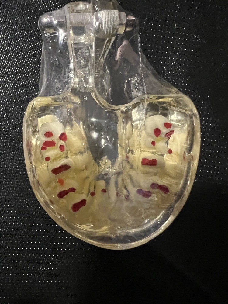 Dental Pathology Demonstration Study Tooth Teeth Model