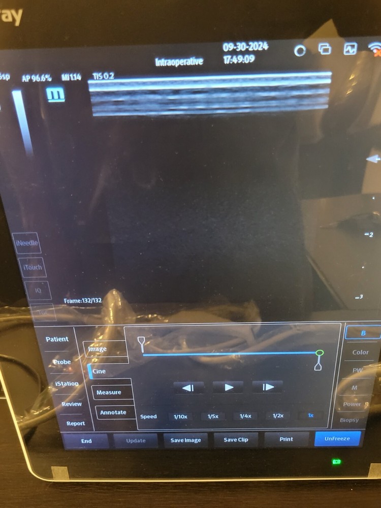 Mindray L14-5sp Intra-operative/msk L-Shape hockey stick linear array transducer