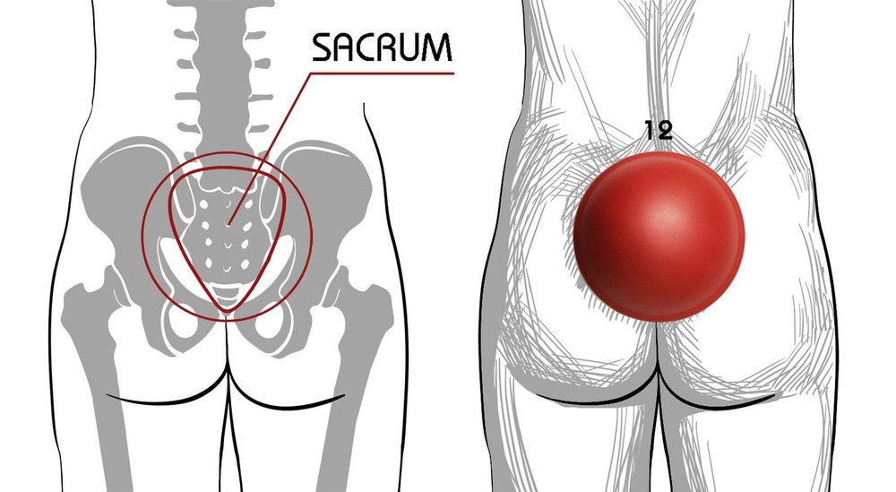 Pelvic Clock® Exercise Device for Chronic Hip & Lower Back Pain Relief
