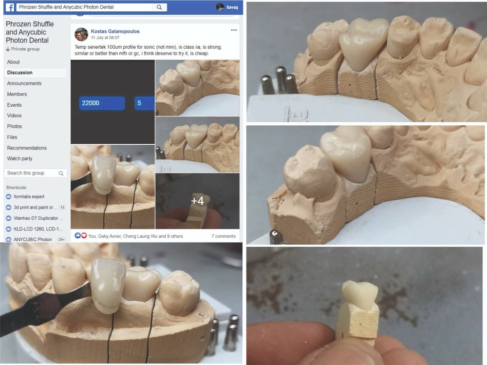 DLP SLA LCD 3d printer temporary teeth resin ..