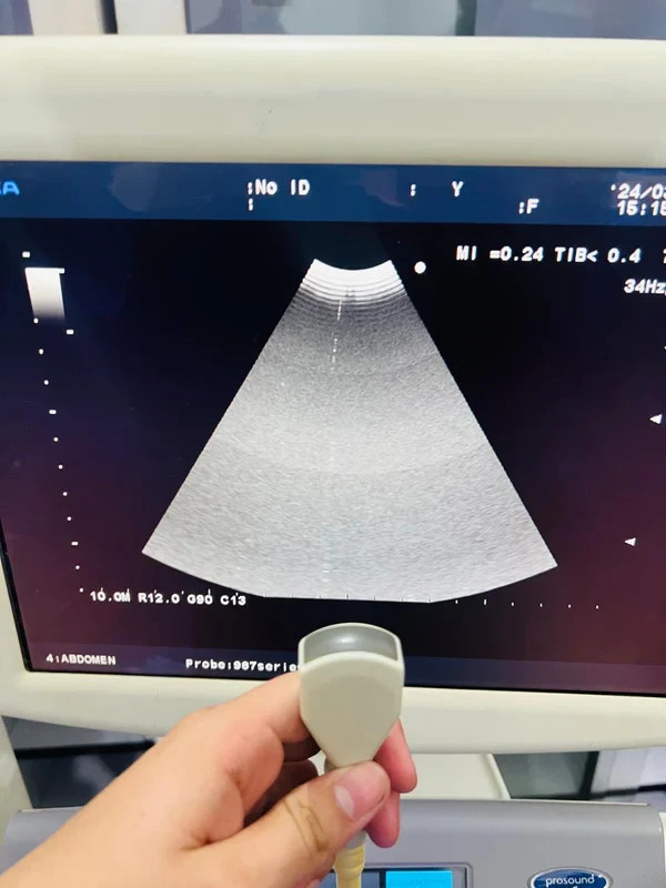 ..Aloka UST-987-7.5 Microconvex probe checked dxb