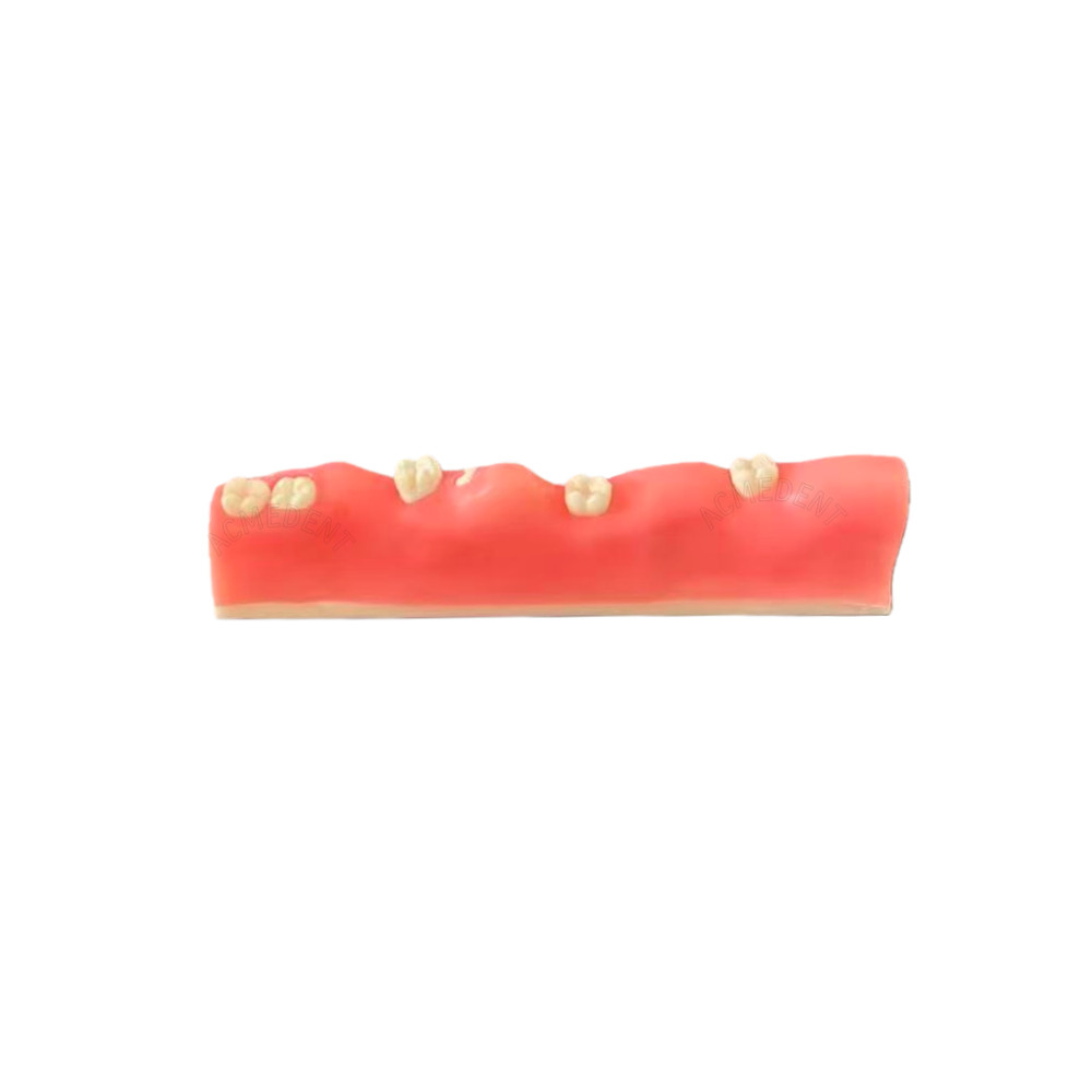 Dental Impacted Tooth Extraction Practice Model Training Gingiva Sutures Test