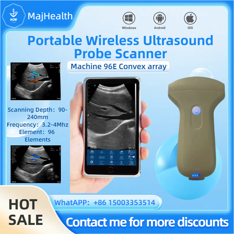 Portable 96E Wireless Ultrasound Scanner Machine w/ Convex Array Probe